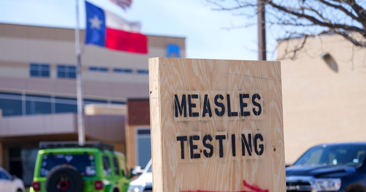 Map shows more than 1,000 measles cases across U.S. as outbreak grows