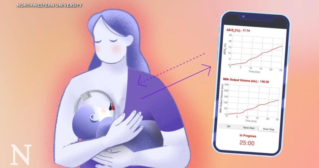New breastfeeding device could ease anxiety for moms and improve NICU care