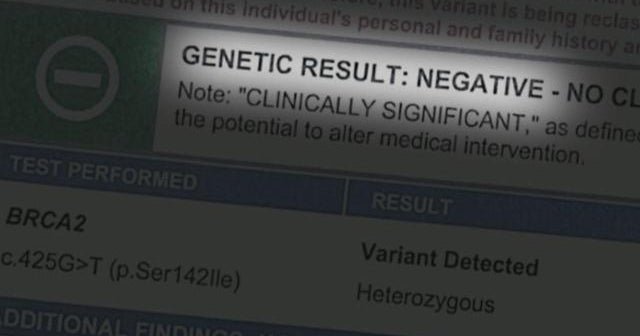 BRCA gene test questioned after unnecessary surgeries